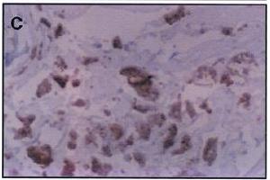 Immunohistochemistry image of dihydropyridine adduct staining in paraffn section of human atherosclerotic aorta. (Malondialdehyde anticorps)