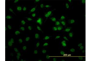 Immunofluorescence of monoclonal antibody to RBBP4 on HeLa cell. (Retinoblastoma Binding Protein 4 anticorps  (AA 316-426))