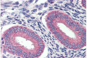 Human Prostate: Formalin-Fixed, Paraffin-Embedded (FFPE)