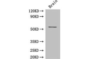 Western Blot Positive WB detected in: Mouse brain tissue All lanes: ASH2L antibody at 3 μg/mL Secondary Goat polyclonal to rabbit IgG at 1/50000 dilution Predicted band size: 69, 57, 61 kDa Observed band size: 69 kDa (ASH2L anticorps  (AA 1-534))