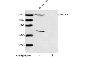 Western blot analysis of tissue lysates using NMDAR1 Antibody (ABIN399084, 1 µg/mL) The signal was developed with IRDyeTM 800 Conjugated Goat Anti-Rabbit IgG. (GRIN1/NMDAR1 anticorps  (AA 900-950))