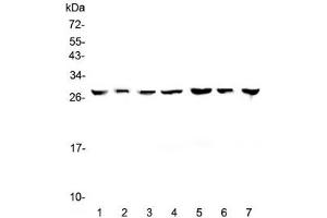 Western blot testing of human 1) HeLa, 2) placenta, 3) HepG2, 4) A549, 5) PANC-1, 6) SK-OV-3 and 7) 22RV1 lysate with 14-3-3 zeta antibody at 0. (14-3-3 zeta anticorps)