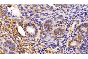 Detection of HMGB1 in Mouse Uterus Tissue using Polyclonal Antibody to High Mobility Group Protein 1 (HMGB1) (HMGB1 anticorps  (AA 1-215))