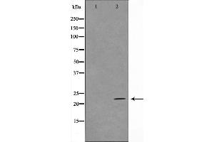 Western blot analysis on HuvEc cell lysate using TFIP8 Antibody,The lane on the left is treated with the antigen-specific peptide. (TNFAIP8 anticorps  (Internal Region))