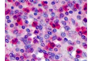 Human Spleen: Formalin-Fixed, Paraffin-Embedded (FFPE)