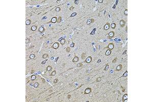 Immunohistochemistry of paraffin-embedded rat brain using MAP1B antibody (ABIN1873595) at dilution of 1:100 (40x lens). (MAP1B anticorps)