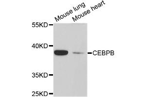 Western blot analysis of extracts of various cell lines, using CEBPB antibody. (CEBPB anticorps)