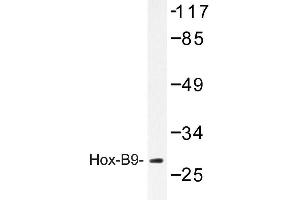 Image no. 1 for anti-Homeobox B9 (HOXB9) antibody (ABIN272173) (HOXB9 anticorps)