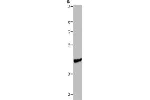 Gel: 8 % SDS-PAGE, Lysate: 40 μg, Lane: Mouse skeletal muscle tissue, Primary antibody: ABIN7191867(PHKG1 Antibody) at dilution 1/200, Secondary antibody: Goat anti rabbit IgG at 1/8000 dilution, Exposure time: 1 minute (PHKG1 anticorps)