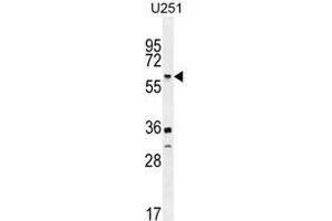 TNFRSF1A Antibody (N-term) western blot analysis in U251 cell line lysates (35 µg/lane). (TNFRSF1A anticorps  (N-Term))