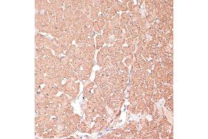 Immunohistochemistry of paraffin-embedded Rat heart using FRMD6 antibody (ABIN6132194, ABIN6140773, ABIN6140774 and ABIN6225347) at dilution of 1:100 (40x lens). (FRMD6 anticorps  (AA 405-614))