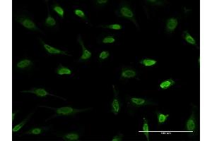 Immunofluorescence of monoclonal antibody to MBD1 on HeLa cell.