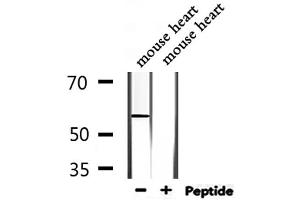 Western blot analysis of extracts from mouse heart, using WASF3 Antibody.