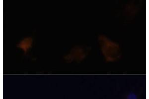 Immunofluorescence analysis of C6 cells using ZYX Polyclonal Antibody at dilution of 1:100. (ZYX anticorps)