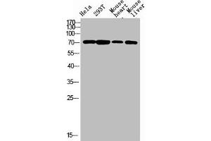 Western blot analysis of varias lysis using F13B antibody. (F13B anticorps  (Internal Region))