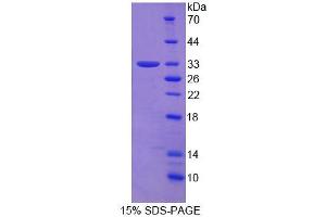SDS-PAGE analysis of Human LPXN Protein. (Leupaxin Protein (LPXN))