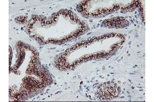 Image no. 6 for anti-Archain 1 (ARCN1) antibody (ABIN1497572)