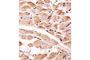 Immunohistochemical analysis of paraffin-embedded H. (PINK1 anticorps)