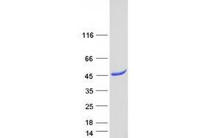 Validation with Western Blot