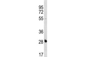 RBPMS antibody western blot analysis in NCI-H460 lysate.