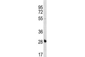 RBPMS antibody western blot analysis in NCI-H460 lysate. (RBPMS anticorps  (AA 166-193))