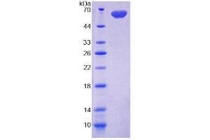 SDS-PAGE analysis of Rat DIO2 Protein. (DIO2 Protéine)