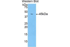 Western blot analysis of the recombinant protein. (LCN8 anticorps  (AA 25-176))