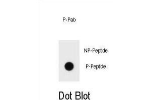 Dot blot analysis of Phospho-bcl-2-S70 Antibody Phospho-specific Pab (ABIN1539712 and ABIN2839909) on nitrocellulose membrane. (Bcl-2 anticorps  (pSer70))