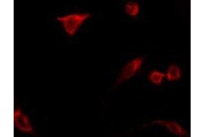 ABIN6275360 staining LOVO by IF/ICC.