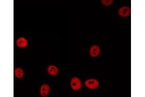 ABIN6274893 staining HeLa by IF/ICC.