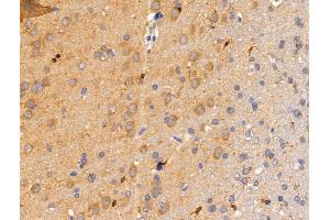 Siglec 7 Antibody at 1/100 staining Rat brain tissue by IHC-P. (SIGLEC7 anticorps  (C-Term))