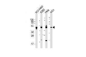 All lanes : Anti-CYK18 Antibody (C-term) at 1:2000 dilution Lane 1: NCI- whole cell lysate Lane 2: K562 whole cell lysate Lane 3: Hela whole cell lysate Lane 4: A431 whole cell lysate Lysates/proteins at 20 μg per lane.