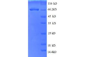 SDS-PAGE (SDS) image for Albumin (ALB) (AA 25-608) protein (His tag) (ABIN5709033)