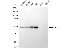 Western blotting analysis using RAD52 antibody (ABIN7800121). (Recombinant RAD52 anticorps)