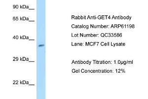 Western Blotting (WB) image for anti-Chromosome 7 Open Reading Frame 20 (C7orf20) (N-Term) antibody (ABIN2788715) (Chromosome 7 Open Reading Frame 20 (C7orf20) (N-Term) anticorps)