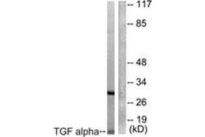 Western blot analysis of extracts from COS7 cells, using TGF alpha Antibody. (TGFA anticorps  (AA 111-160))
