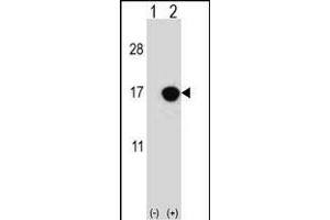Western blot analysis of CDKN2B (arrow) using rabbit polyclonal CDKN2B Antibody (C-term) (ABIN656561 and ABIN2845822). (CDKN2B anticorps  (C-Term))