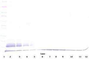 Image no. 3 for anti-Chemokine (C-C Motif) Ligand 22 (CCL22) antibody (ABIN465130) (CCL22 anticorps)