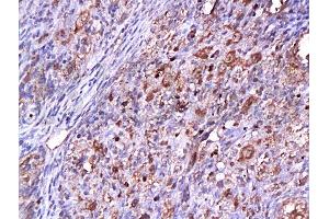 Immunohistochemistry (Paraffin-embedded Sections) (IHC (p)) image for anti-Cyclin-Dependent Kinase 2 (CDK2) (AA 1-100) antibody (ABIN2172819) (CDK2 anticorps  (AA 1-100))
