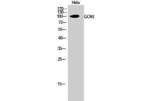 Western Blotting (WB) image for anti-K(lysine) Acetyltransferase 2A (KAT2A) (C-Term) antibody (ABIN3175241) (KAT2A anticorps  (C-Term))