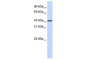 FBXO28 antibody used at 1 ug/ml to detect target protein. (FBXO28 anticorps  (Middle Region))