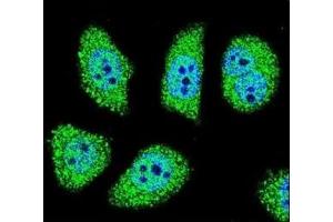 Confocal immunofluorescent analysis of PAK6 antibody with U-251MG cells followed by Alexa Fluor 488-conjugated goat anti-rabbit lgG (green).