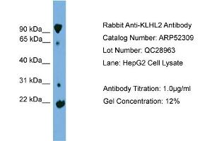WB Suggested Anti-KLHL2  Antibody Titration: 0. (KLHL2 anticorps  (Middle Region))