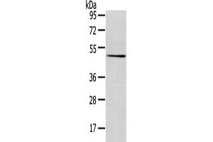 Gel: 8 % SDS-PAGE,Lysate: 40 μg,Primary antibody: ABIN7131404(TMPRSS4 Antibody) at dilution 1/500 dilution,Secondary antibody: Goat anti rabbit IgG at 1/8000 dilution,Exposure time: 3 minutes (TMPRSS4 anticorps)