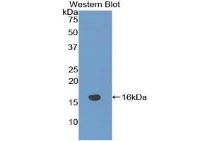 Western blot analysis of the recombinant protein. (NRARP anticorps  (AA 3-109))