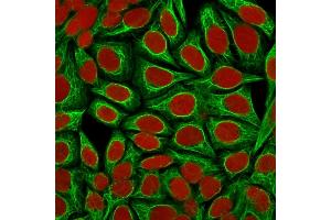 Confocal immunofluorescence image of HeLa cells using Cytokeratin 18 Mouse Monoclonal Antibody (KRT18/1190). (Cytokeratin 18 anticorps)