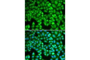 Immunofluorescence analysis of U2OS cells using WAS antibody. (WASP anticorps  (AA 60-250))