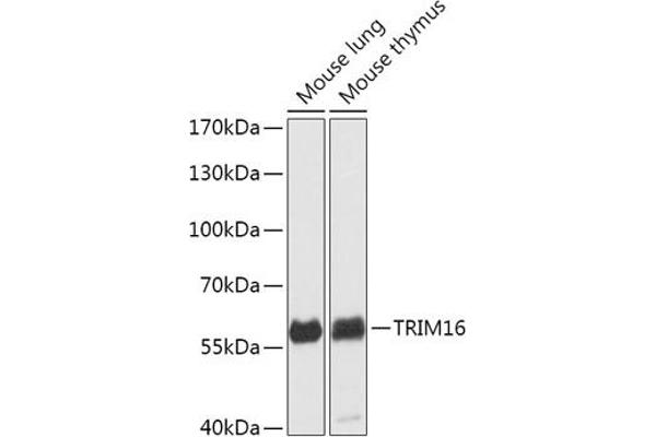 TRIM16 antibody  (AA 1-210)
