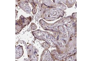 Immunohistochemical staining (Formalin-fixed paraffin-embedded sections) of human placenta with CSF3R polyclonal antibody  shows moderate cytoplasmic positivity in trophoblastic cells. (CSF3R anticorps  (AA 420-543))