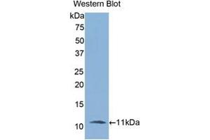 Western blot analysis of the recombinant protein. (IL-6 Receptor anticorps  (AA 19-108))